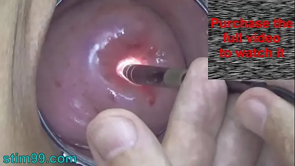 Mostra Endoscopic Camera in Cervix watch inside my Womb and Vagina. Inspection testing exam of wife by extreme doctor gynecologisttubo caldo