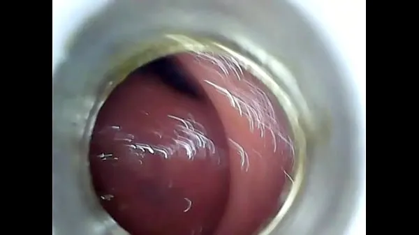 Mostrar Endoscopio de inserción anal caserotubo caliente