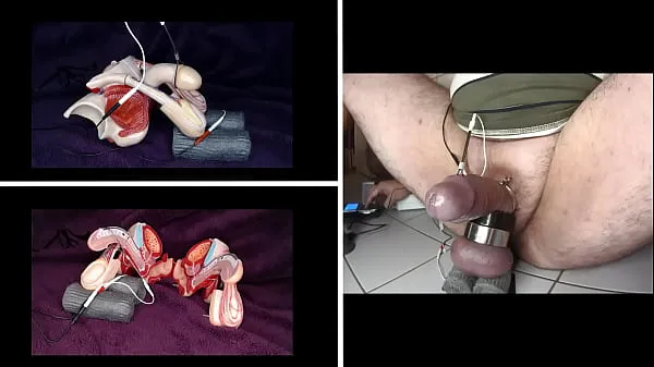 Vis electrical stimulation of the testicles varmt rør